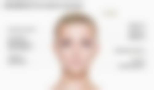 打瘦脸针打麻药吗——注射后的注意事项