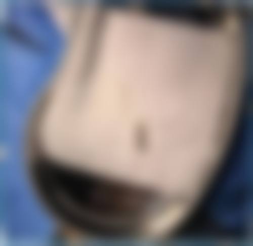 驻马店丽人美容医院整形科怎么样，口碑评价如何？