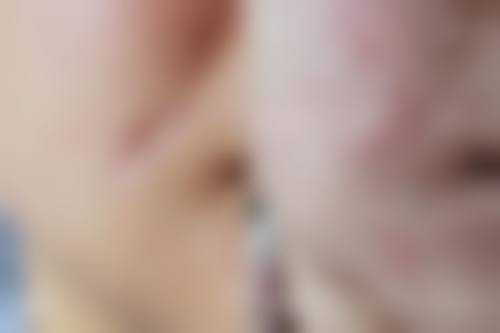 Skinique皮肤科怎么样,上班时间及地址