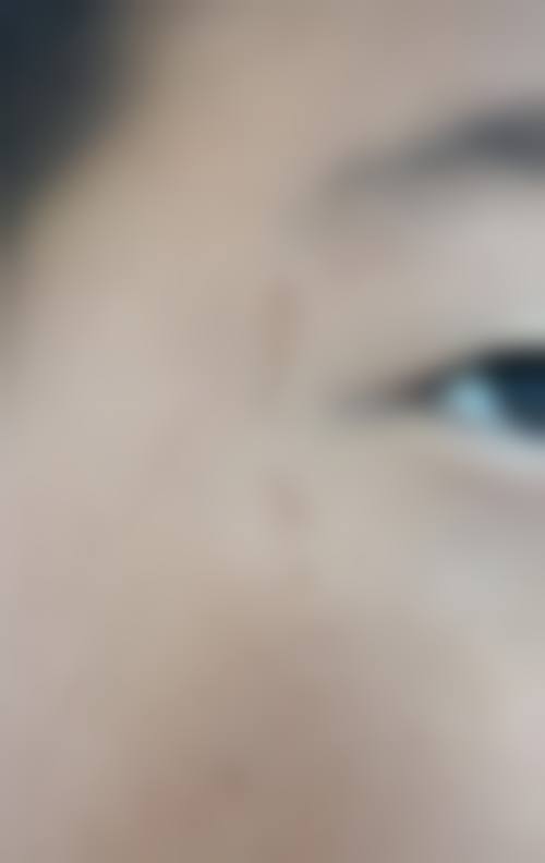 Skinique皮肤科怎么样,抖音团购活动及价格表