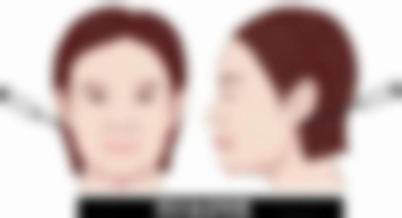 景丽峰医生做手术价格情况