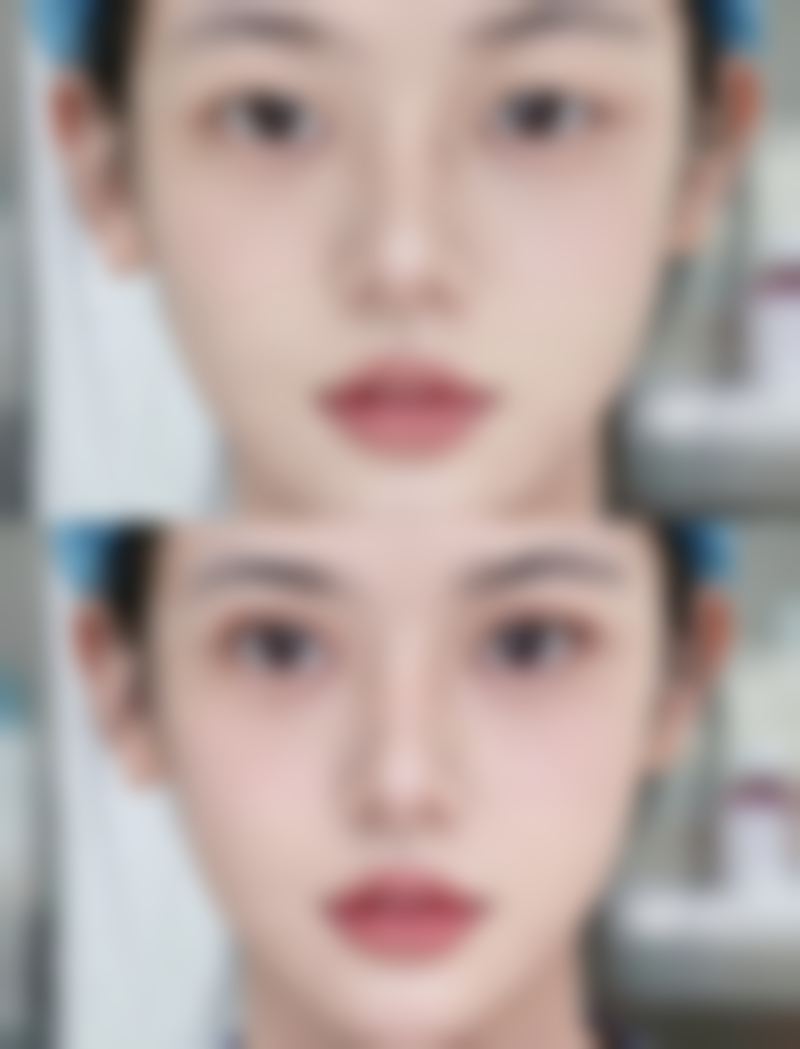 什么牌子瘦脸针更好：咬肌大的优选——衡力