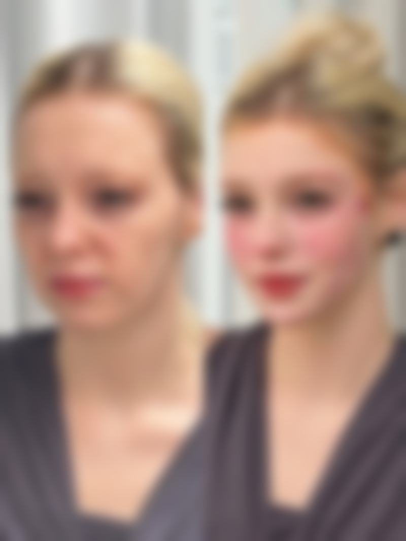 总结：内窥镜隆胸怎么选