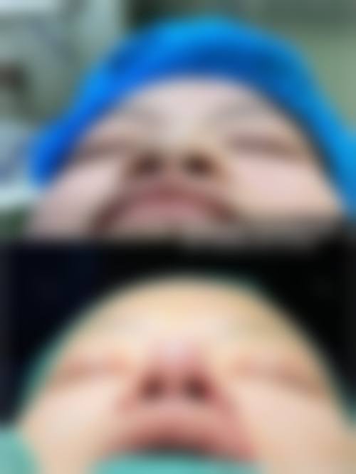 瘦脸针可以瘦屁股吗——岩之畔医巢(北京)医疗美容门诊部有限公司详情