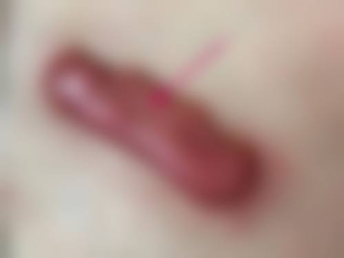 佛山市第五人民医院整形美容科项目特色