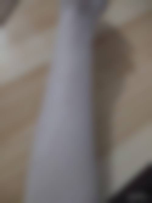 皮肤疤痕体质怎么治疗——四川友谊医院