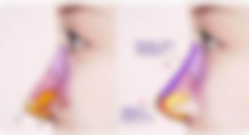 广州高尚医学美容中 心栾翰林收费与精良设备的关系