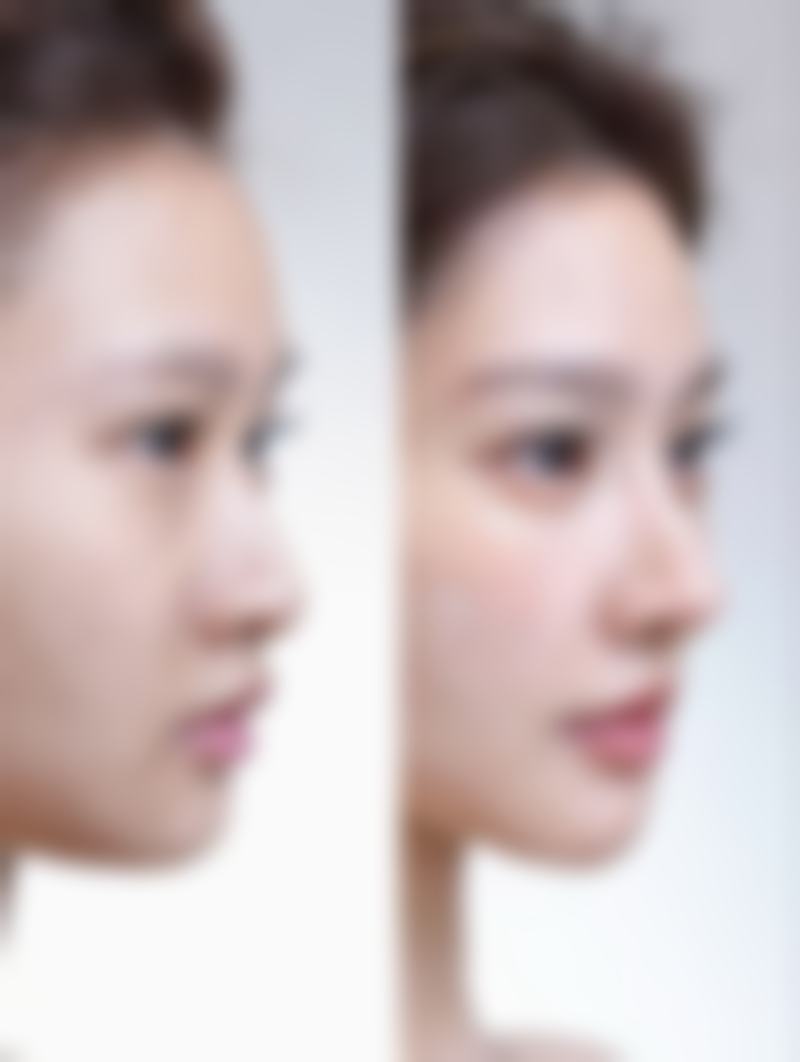 瘦脸针可以瘦屁股吗——深圳新浩创美医疗美容门诊部详情