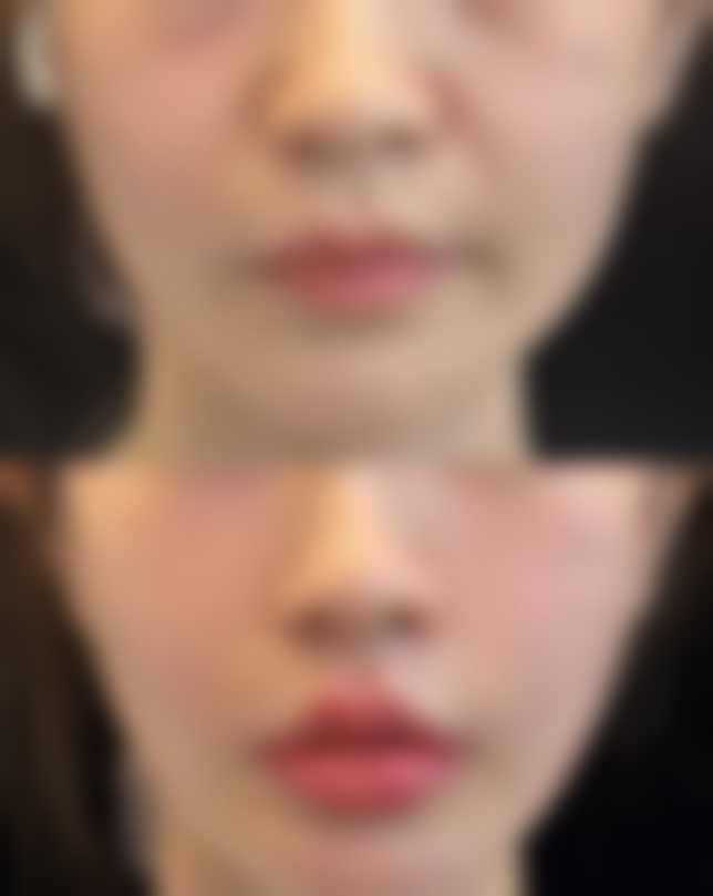 瘦脸针可以瘦屁股吗——北京臻悦医疗美容门诊部（望京店）详情