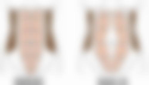 陈旧性烧伤疤痕：时间不是问题能去掉吗