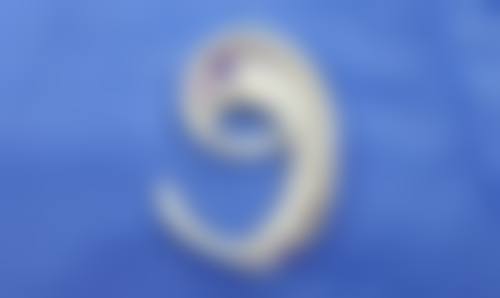 桐乡奥菲诗整形医院口碑好不好