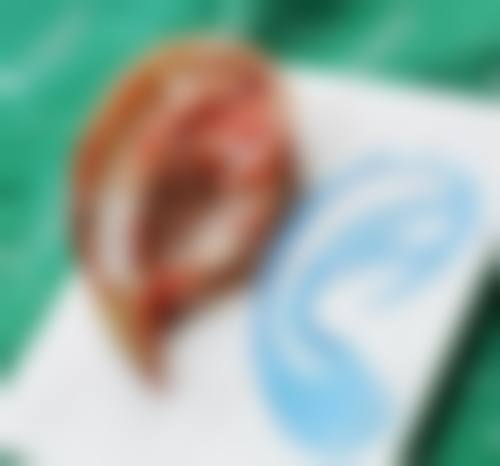 苏州姑苏区医颜整形医院口碑好不好？附真实患者口碑评价