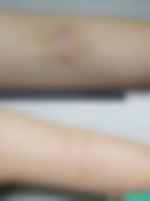 刘懿婵医生简介项目优势