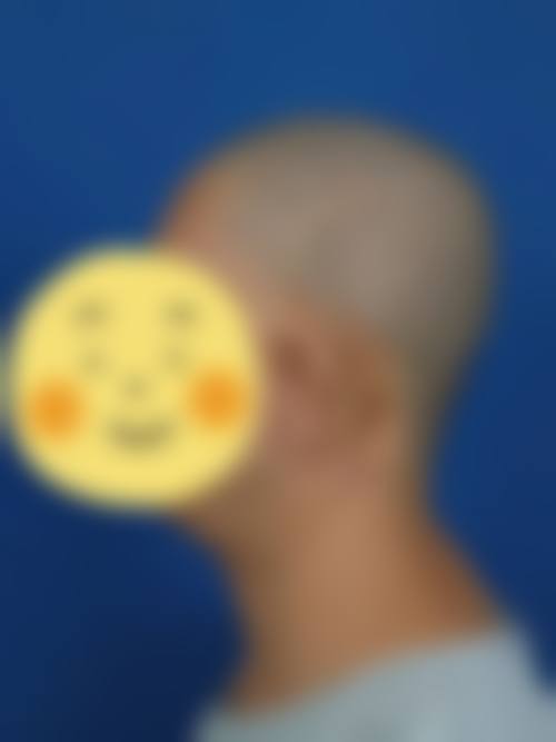 三、杭州迪贝雅虞悦整形医院怎么样，口碑评价如何？