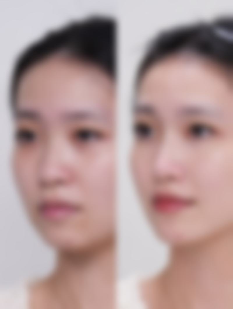 杭州占美整形医院怎么样，口碑评价如何？