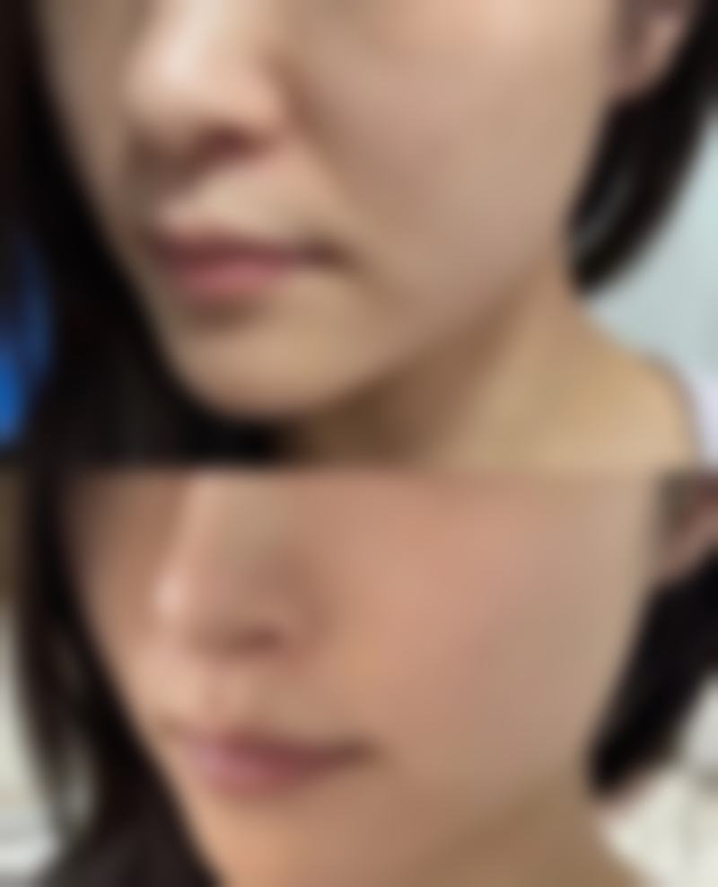 辽阳燕丽整形医院价格表