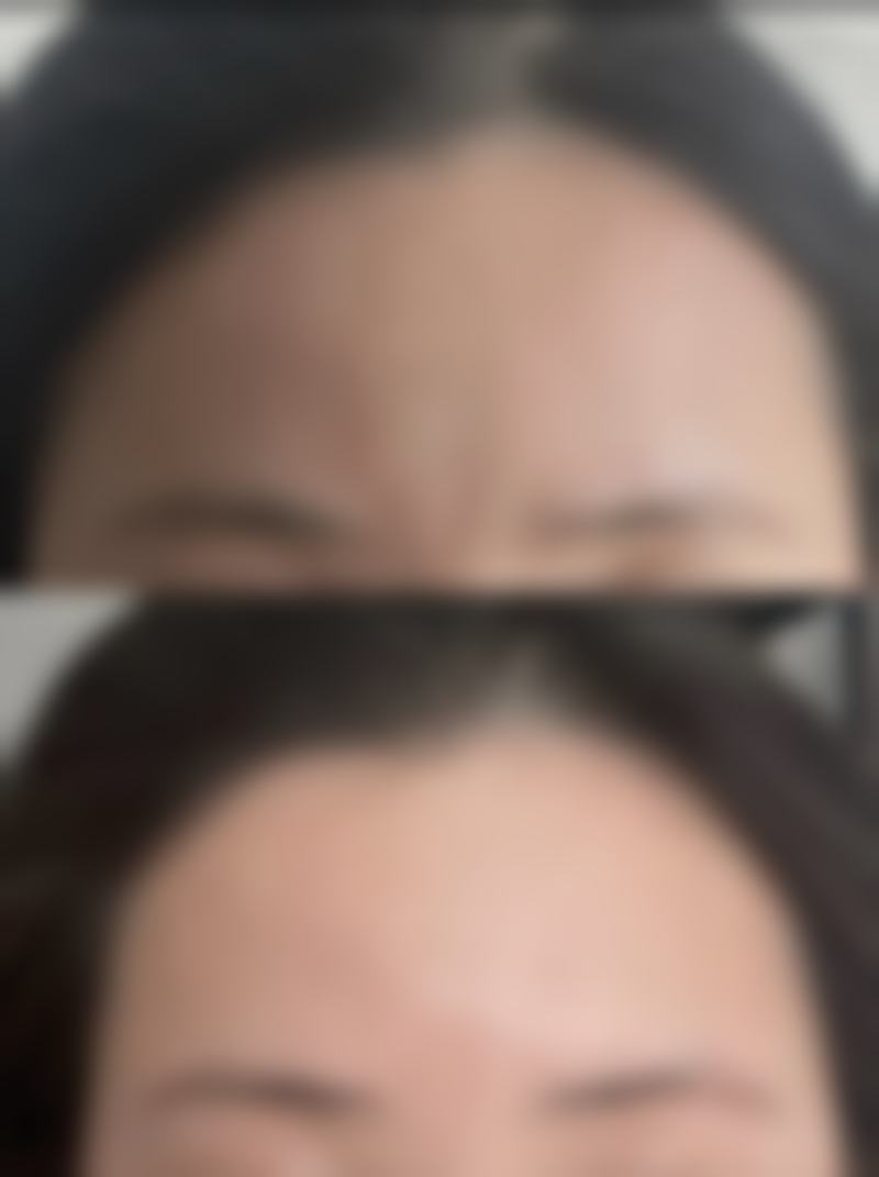 瘦脸针一般多少个单位——衡阳雅美医疗美容医院的项目详情