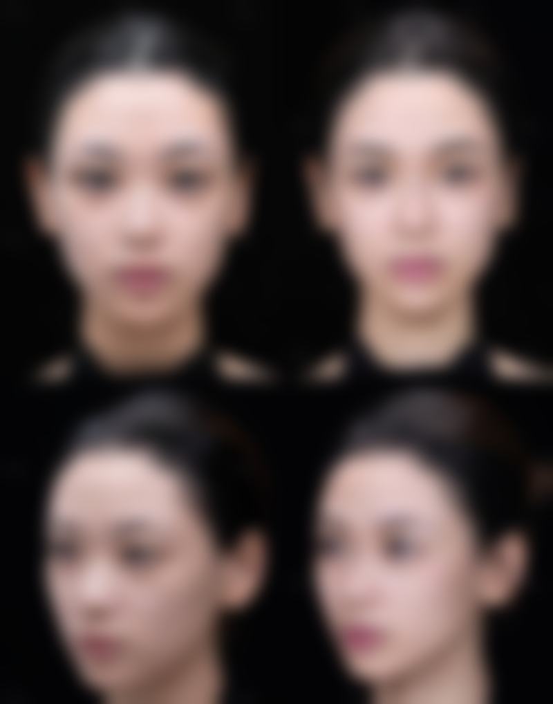 杭州昕微整形医疗美容医院口碑好不好