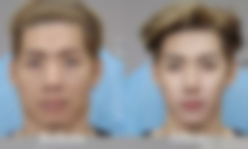 儿童烧伤疤痕：早干预成效更好能去掉吗