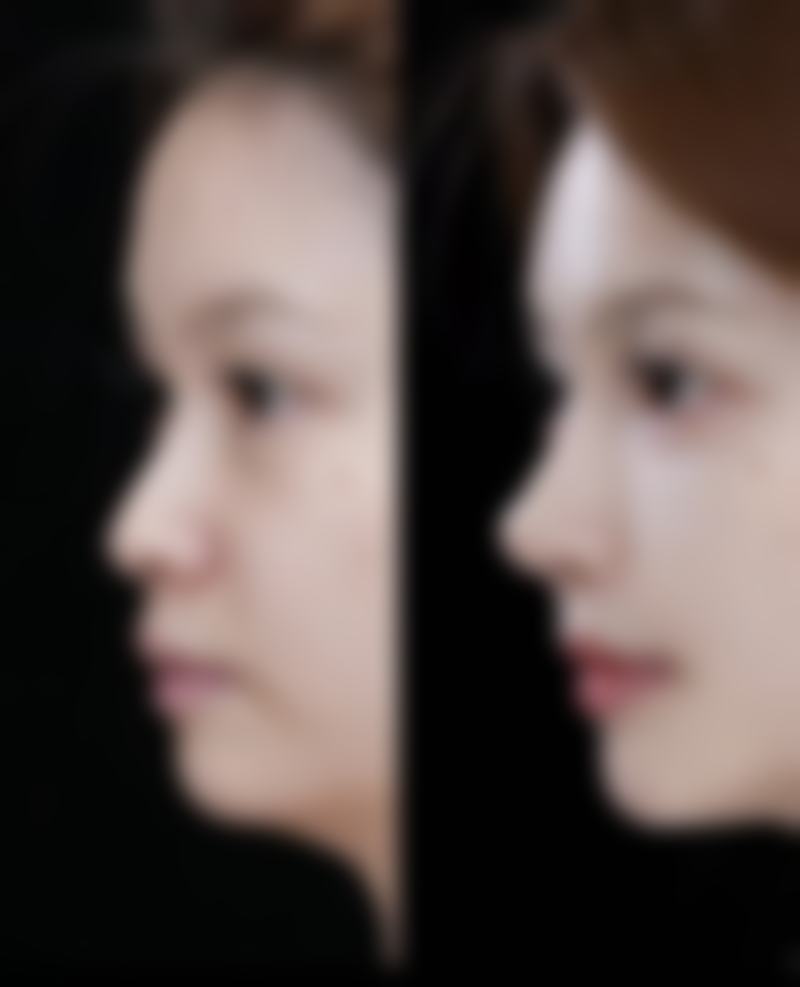 包头云庆医疗美容诊所价格表