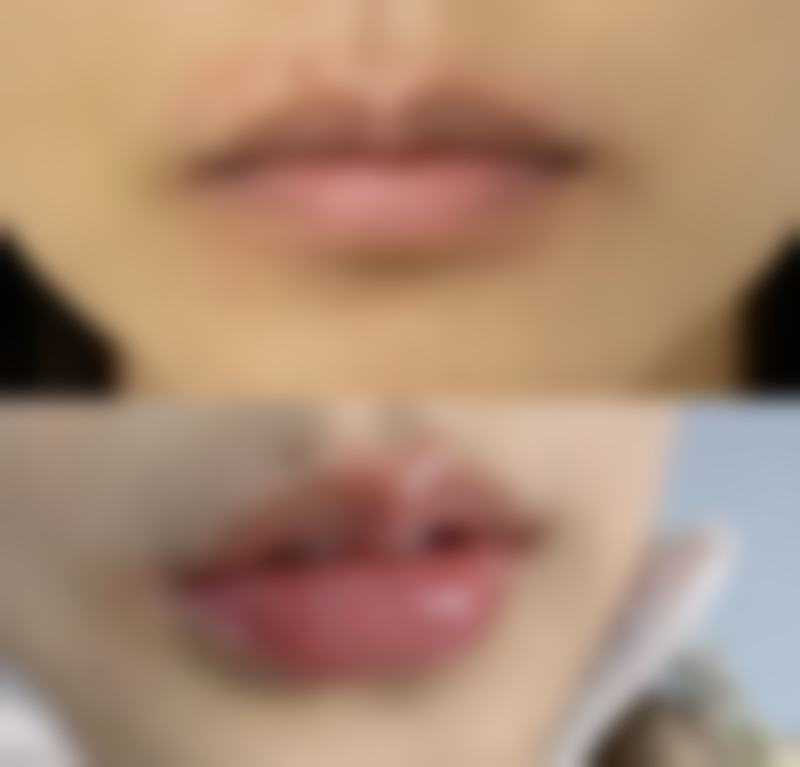 用牙签划出双眼皮之在家DIY注意事项：安心第一，美丽第二