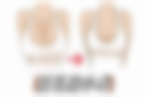 消除眼袋的10种方法之运动疗法：让眼周肌肉“做体操”