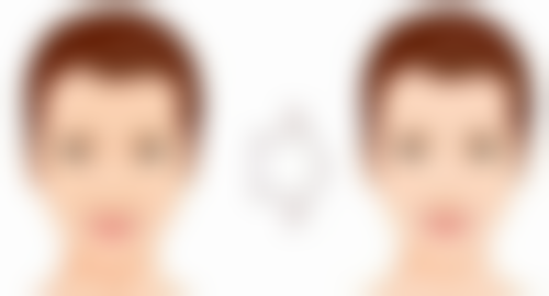 做完腹部吸脂手术多久可以喝酒：多维度护理与饮酒时机把控