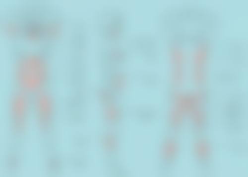 激光治疗疤痕增生黑色素沉淀多久消