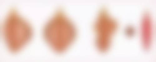 徐炜医生简介项目优势