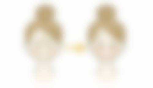 割双眼皮的多久修复——宜昌蕾帝整形美容医院