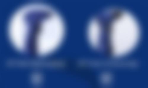 50岁做双眼皮全切的成效呈现