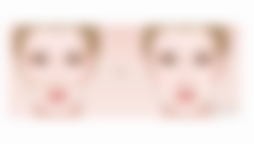 做完手臂吸脂手术多久可以喝酒：多因素决定饮酒时间