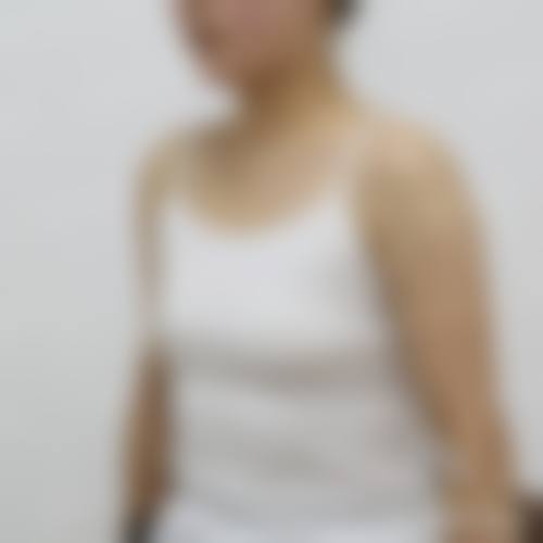 隆胸手术属于大手术吗？——武汉美基元医疗美容医院