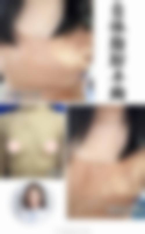 隆胸手术属于大手术吗？——北京华韩