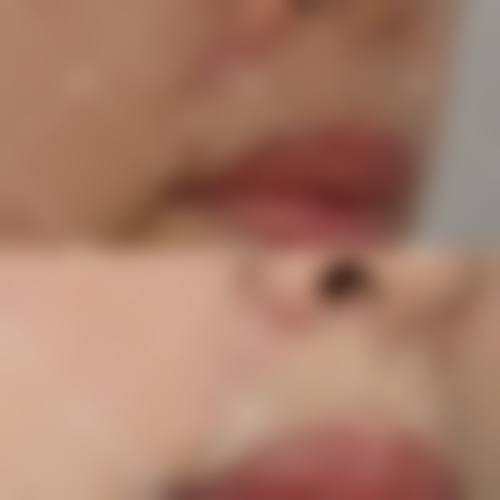 东莞南城罗恩整形医院项目特色