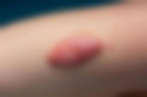 上海瑞金医院舟山分院烧伤整形美容科真实患者口碑评价