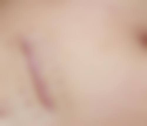 上海瑞金医院舟山分院烧伤整形美容科医生简介