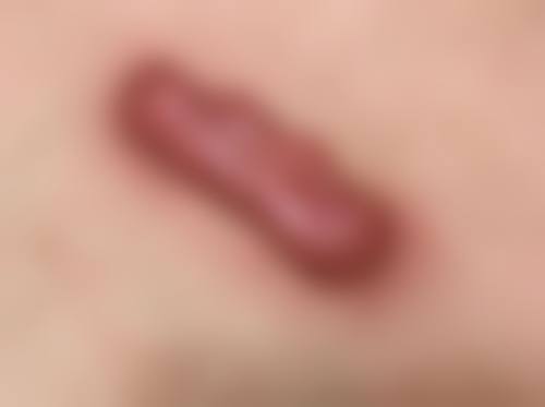 上海瑞金医院舟山分院烧伤整形美容科价格表