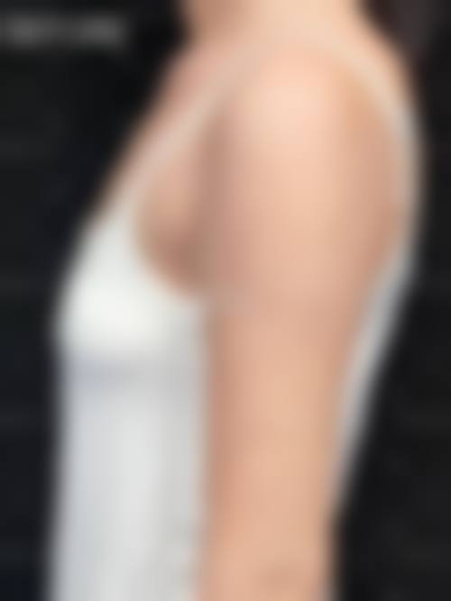 隆胸手术属于大手术吗？——韩国wooa整形医院