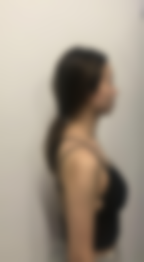 隆胸手术属于大手术吗？——武汉仁爱时光医疗美容门诊部