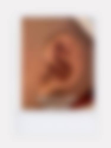 东莞南城罗恩整形医院口碑好不好?附真实患者口碑评价