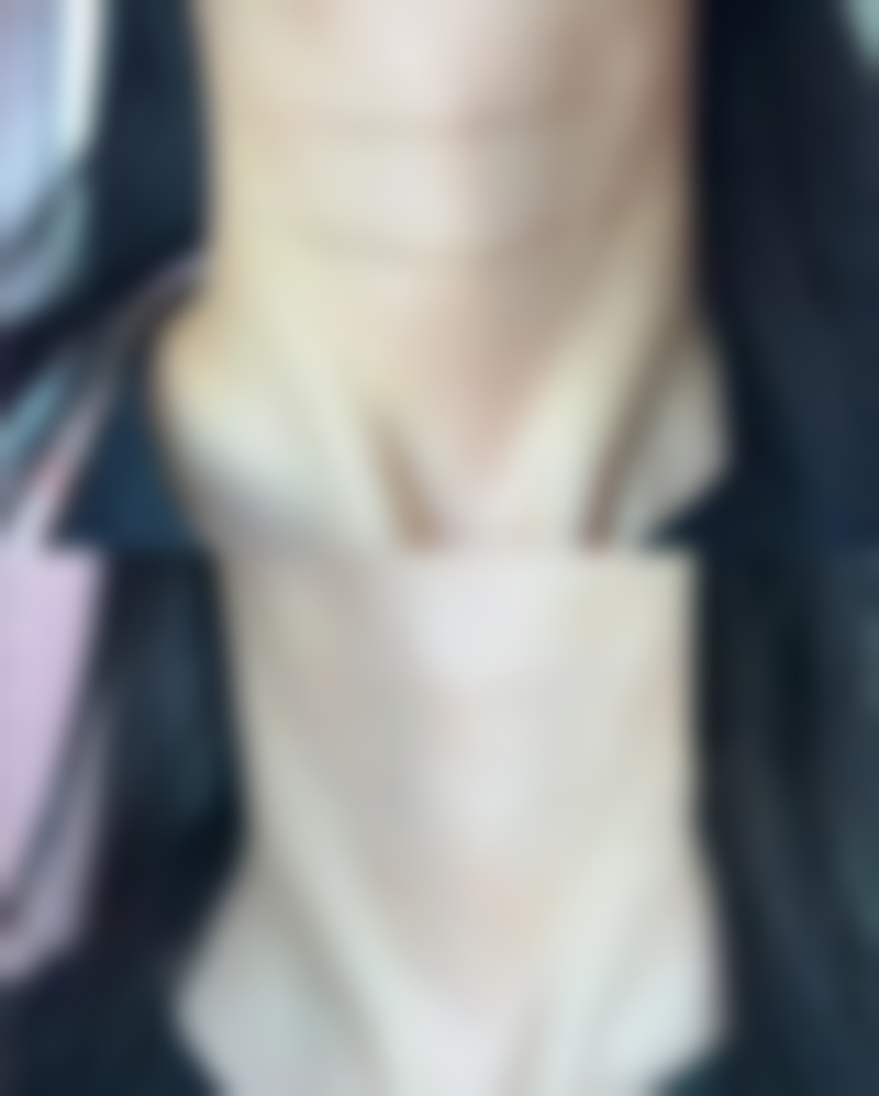 疤痕增生导致的黑色素沉淀形成原因及消除时间差异