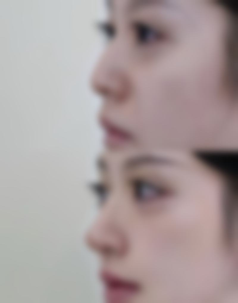 上海东方丽人医疗美容抖音团购活动有哪些，价格表