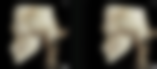 家庭自然妙招如何去除疤痕疙瘩呢