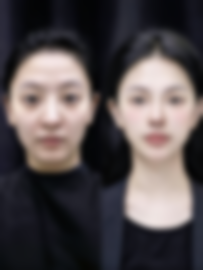 消除眼袋的10种方法之中医调理：内外兼治的“治本之道”