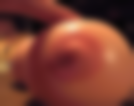 做双眼皮有必要提肌吗:给不同人群的贴心建议