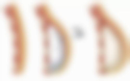 抓伤的伤疤痕迹怎么消除之民间祛疤偏方：哪些真的有效？