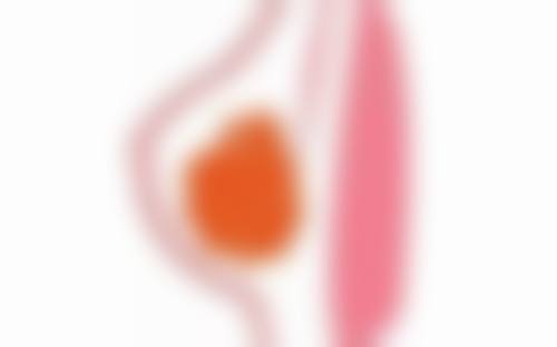 隆胸以后会有什么危害——CC医疗美容医院情况