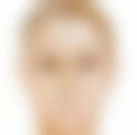 双眼皮窄了怎么修复：常见疑问——专精解答消除顾虑