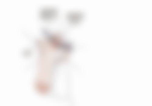 杭州伊琳医疗美容整形医院实例展示